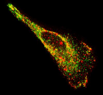 New Way To See Single RNA Molecules Inside Living Cells